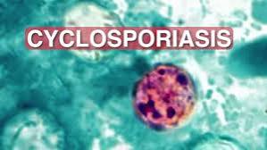 Parasite Linked to Raw Produce Sparks Diarrhea Outbreak Across Multiple States